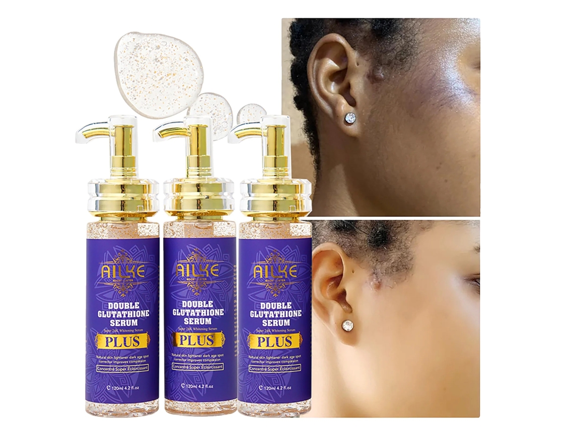 Set de cuidado de la piel con glutatión Ailke: loción de 3 frascos, corrector de manchas oscuras y suero (3 frascos OEM)