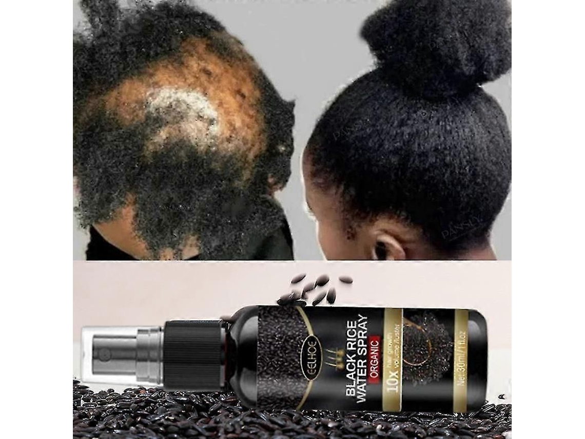 Spray Para El Crecimiento Del Cabello Con Arroz Negro: Repara El Cabello Dañado E Hidrata Todo Tipo De Cabello (3 Unidades).
