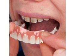 Facetas dentárias postiças ultrafinas de silicone branco, brilhantes, seguras e adesivas, para disfarçar manchas e espaços, proporcionando um sorriso perfeito.