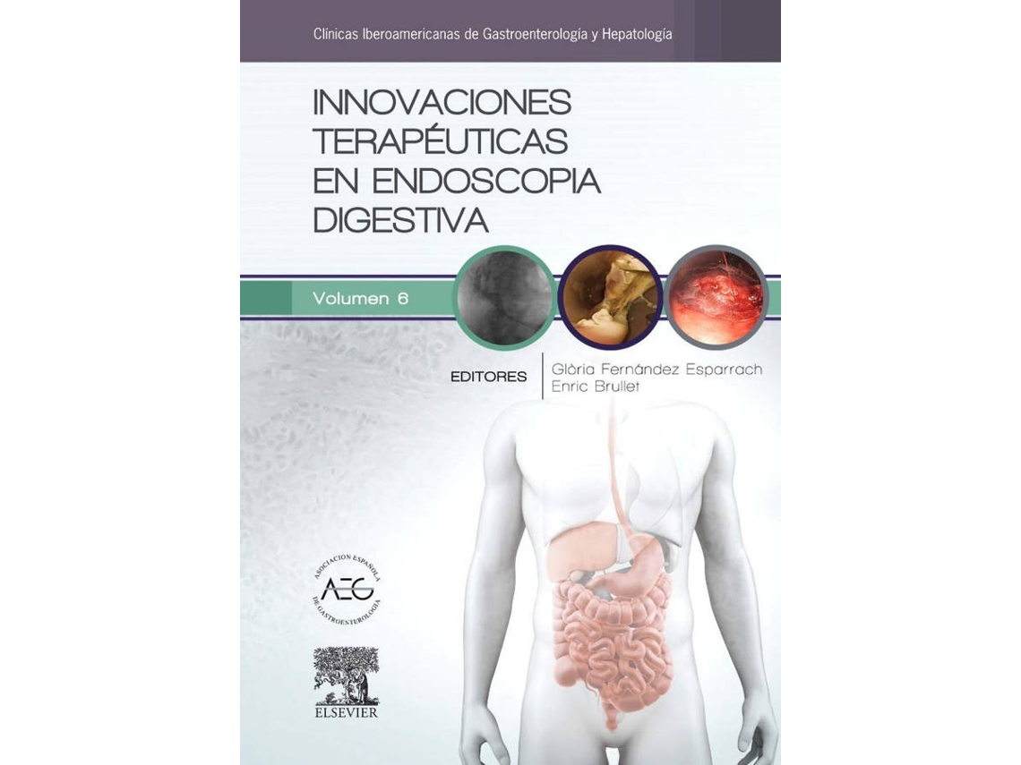 Libro Innovaciones Terapéuticas En Endoscopia Digestiva de M.G. Fernandez Esparrach (Español)