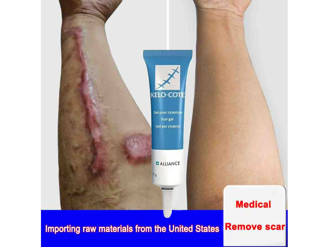 Crema para eliminar cicatrices de acné y marcas de tensión