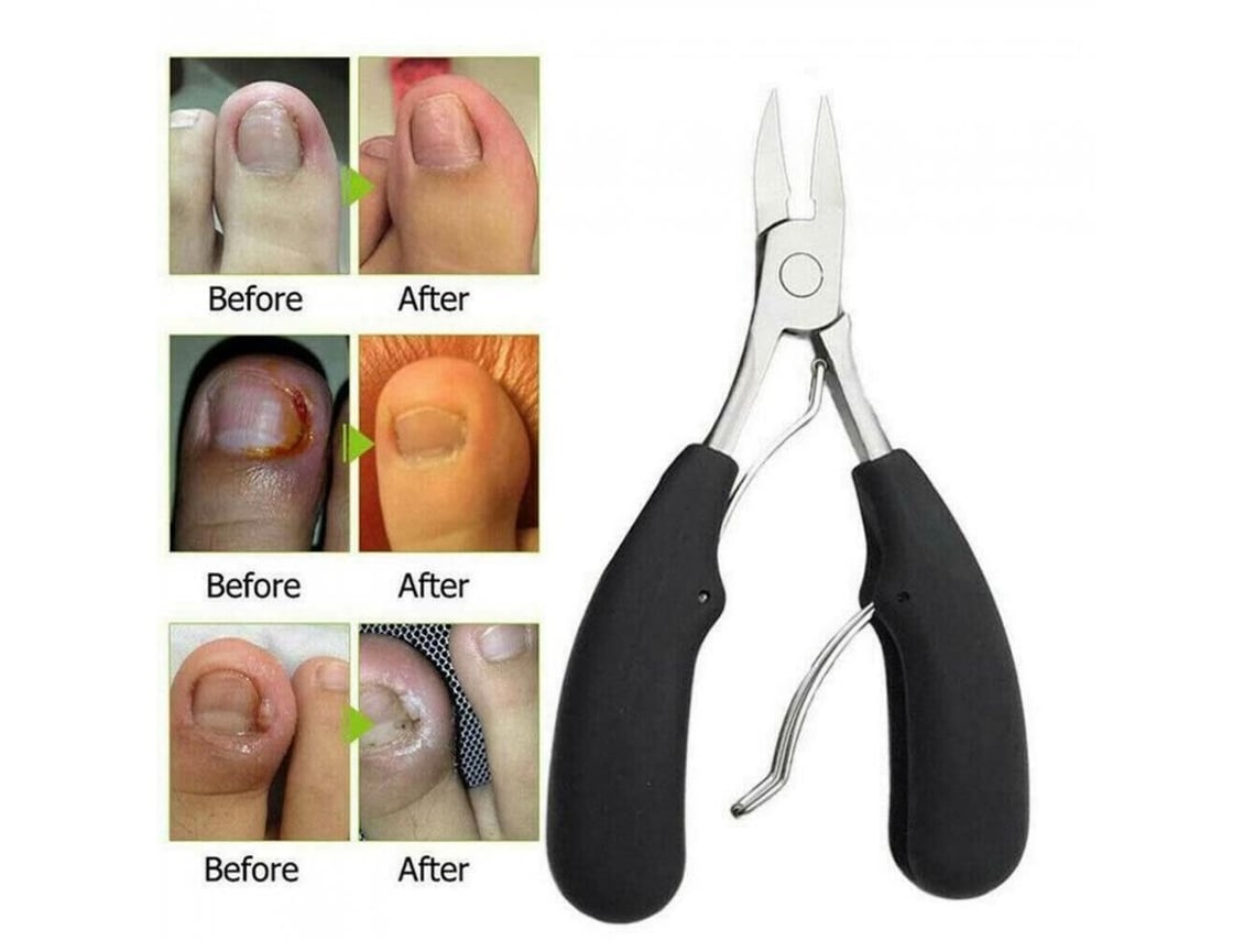 Tijeras Profesionales Para Uñas De Los Pies De Acero Inoxidable Grueso Con Mango Antideslizante De Abs.