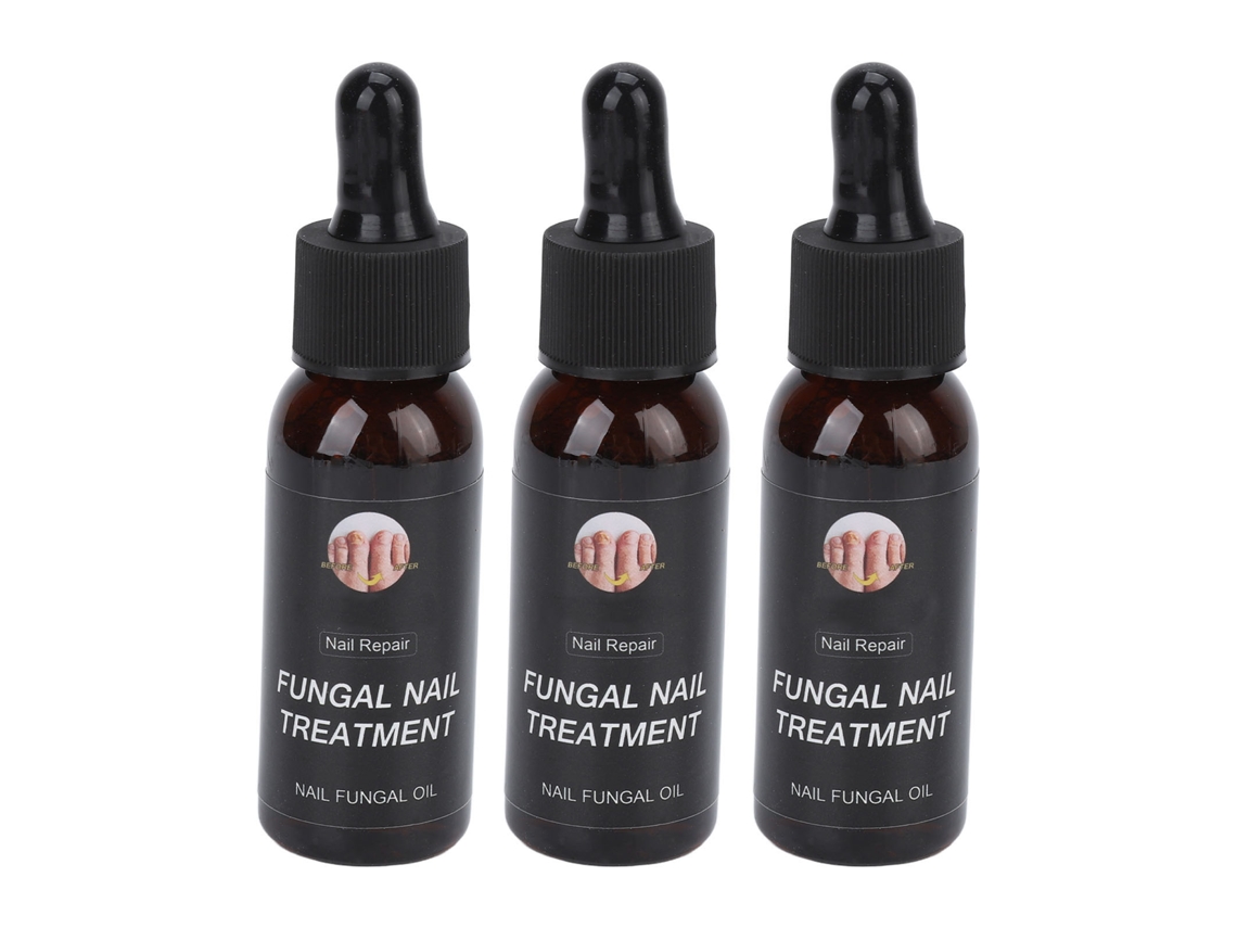 Aceite para uñas 30 ml (3 unidades), fortalecedor, hidratante y reparador para uñas quebradizas y descamadas.