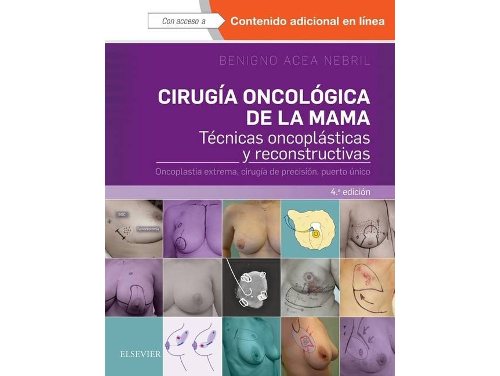 Libro Cirugía Oncológica De La Mama de Benigno Acea Nebril (Español)