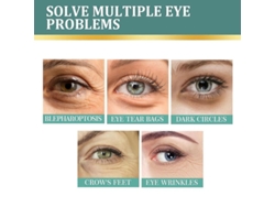 Crema Para El Contorno De Ojos Con Jazmín, Colágeno Y Aloe Vera: Elimina Ojeras, Bolsas Y Arrugas.
