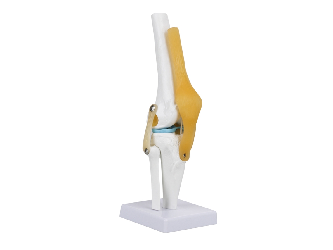 Modelo A Escala Real De La Articulación De La Rodilla Humana Con Ligamentos Para El Estudio De La Anatomía Esquelética.
