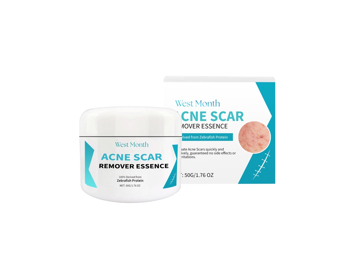 Crema hidratante antiimperfecciones y antiacné de Worten