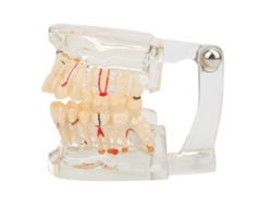 Modelo Transparente De Implante Dental Para La Enseñanza Y El Estudio Hospitalario.