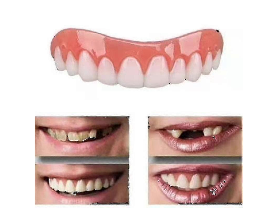 2 Conjuntos De Próteses Dentárias Superior E Inferior, Naturais E Confortáveis, Protegem Os Dentes E Recuperam Um Sorriso Confidente