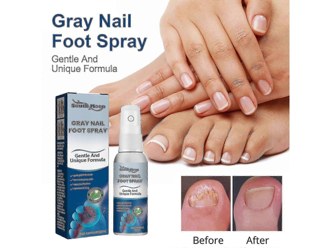 South Moon Onychomycosis Repair Spray Moisturizes And Cleans Odor Onychomycosis Soft Nail Dry Na