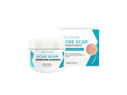 Crema hidratante antiimperfecciones y antiacné de Worten