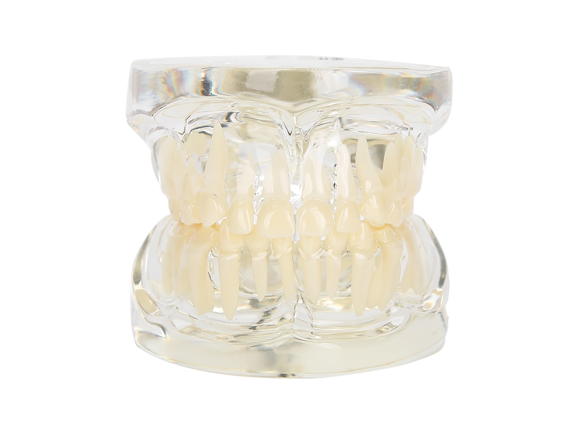 KOFIHETY Modelo de Dientes Deciduos Dentales con Dientes Extraíbles - Herramienta Educativa para Dentistas