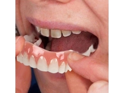 As lentes de contato dentais Rebe-falsas, ultrafinas e brancas, possuem adesivo seguro que disfarça manchas e espaços, garantindo um sorriso perfeito.