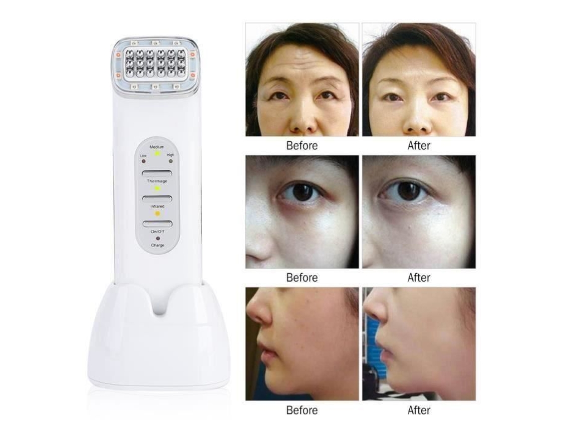 Máquina de masaje facial Máquina de radiofrecuencia Máquina de rejuvenecimiento de la piel