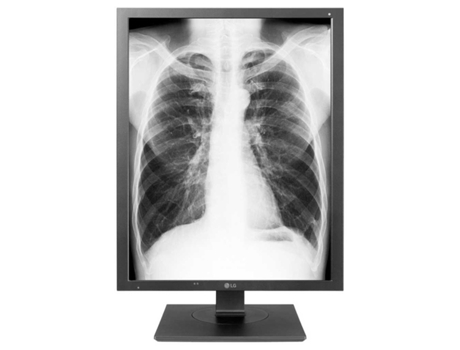 VPMKP - Lg Medical Diagnostic 3Mp