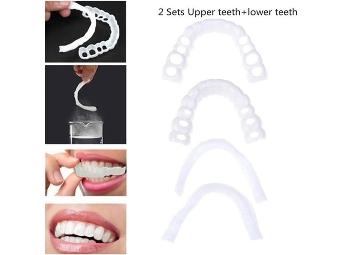 Las Prótesis Dentales Cubren Los Empastes Superiores E Inferiores, Creando Dientes Postizos Blancos Y Luciendo Hermosas Sonrisas.*