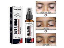 Vitiligo Treatment Spr