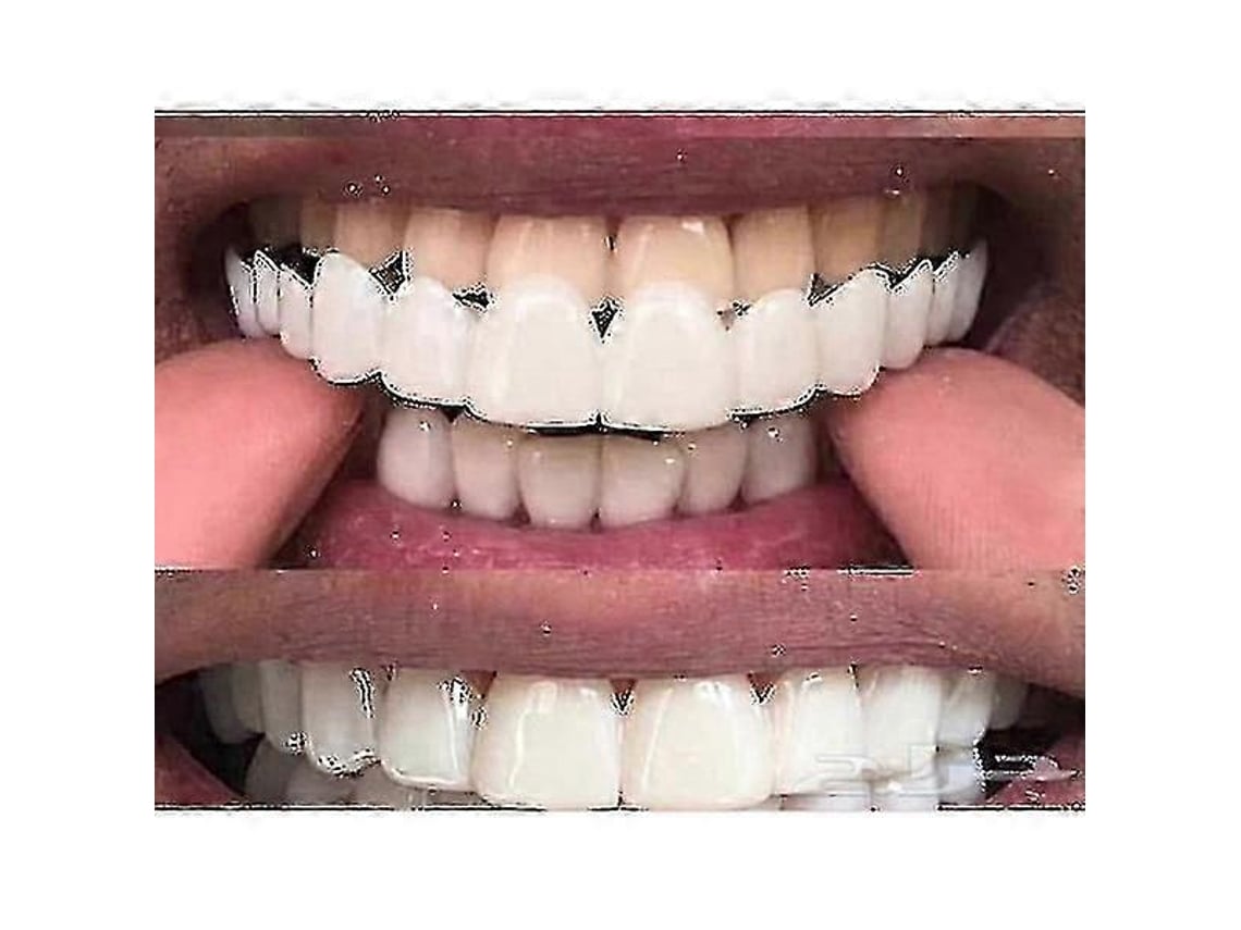 Dispositivos flexibles para blanquear prótesis dentales Ajuste cómodo Dientes superiores/inferiores Yuhao