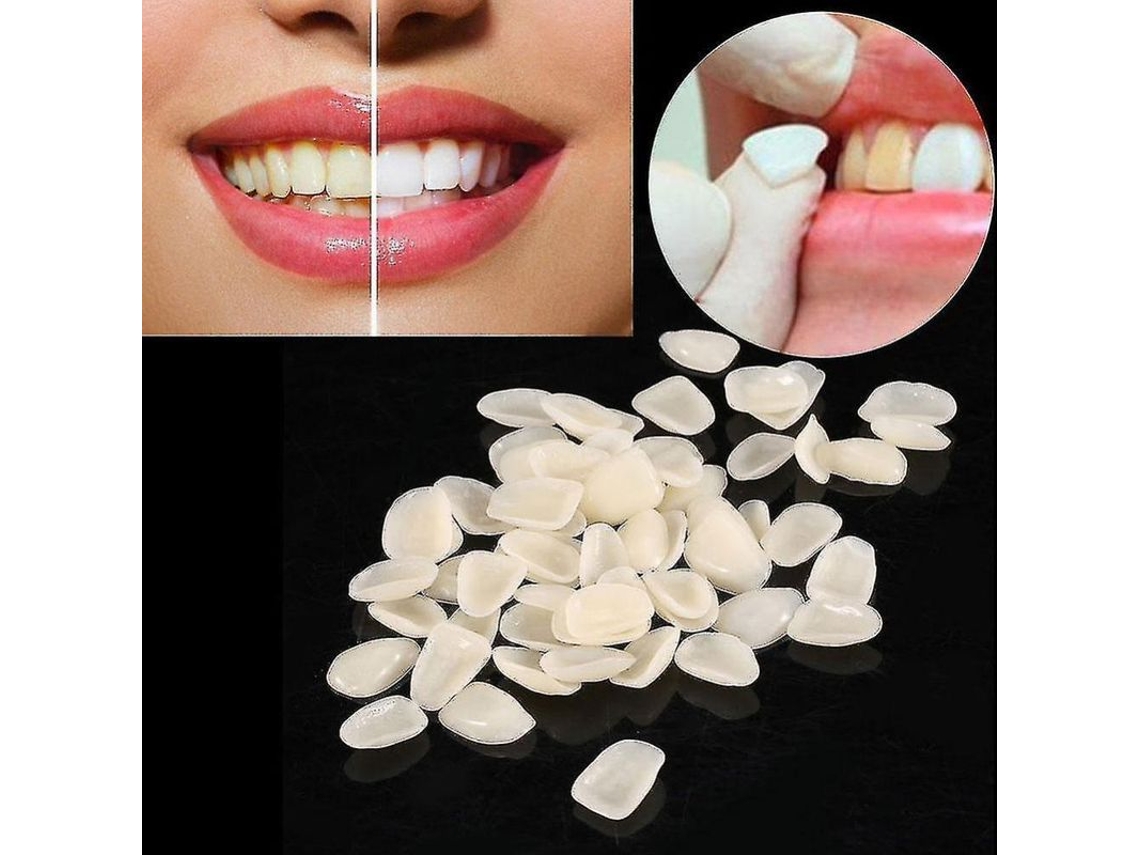 Láminas Ultrafinas De Resina Compuesta Para Dientes Anteriores Superiores, Ozk Restoratives