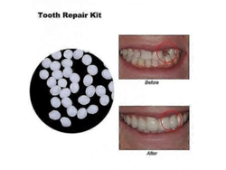 Kit De Restauración Dental: Adhesivo De Resina Sólida Para Prótesis Dentales, 50 G.