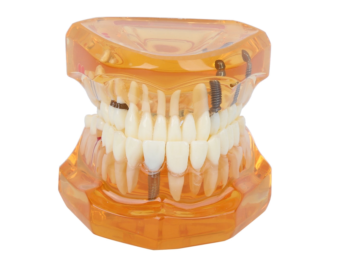 Modelo De Dientes Desmontable Naranja Para Enseñanza Y Estudio Dental