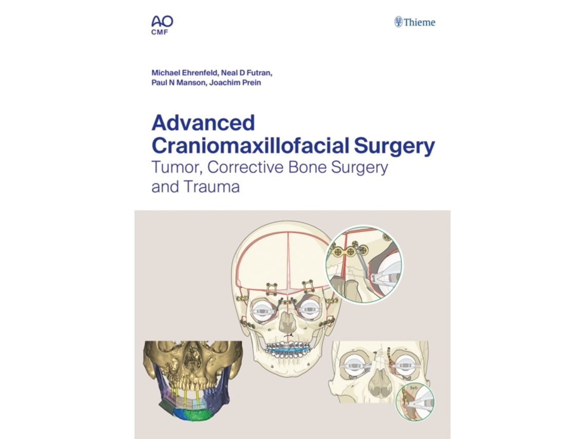 Libro Advanced Craniomaxillofacial Surgery (Inglés)