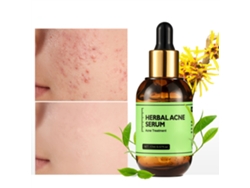 Sérum antiacné para controlar la grasa y reducir las cicatrices del acné.