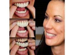 Prótesis Dentales Superiores E Inferiores De La Mejor Calidad, Dentaduras Postizas De Alta Calidad, Sonrisa Instantánea, Ajuste Cómodo, Dientes Cosméticos Flexibles.