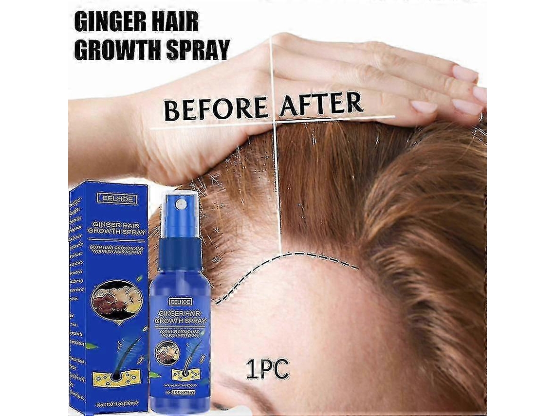 1pc—1pc Ginger Hair Spray Scalp Massage Moisturizing Thick Hair Hair Care Nutrition Spray