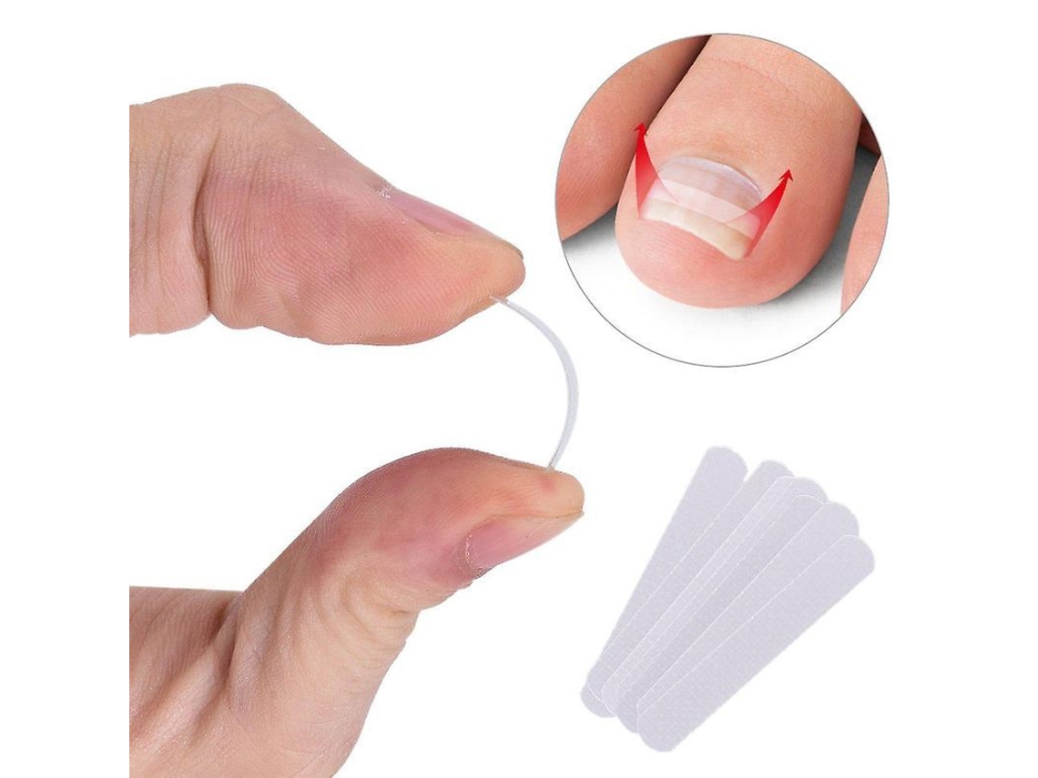 Herramienta De Pedicura Para Uñas Encarnadas (10 Unidades) / Clip De Retoque Para Paroniquia Y Uñas Gruesas