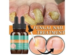 30ml Líquido Antifúngico Para Unhas De Dedos E Pés Com Ingredientes Suaves E Design De Pincel Pequeno