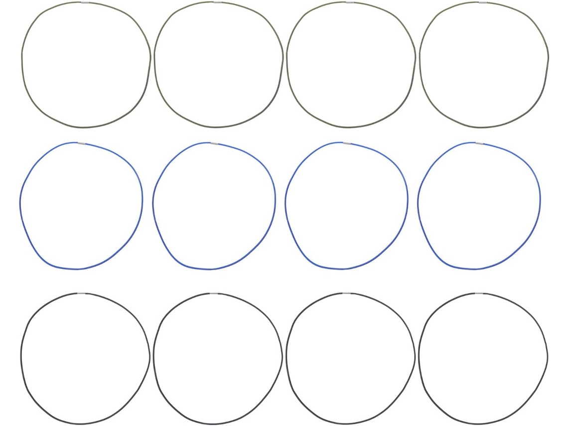 Juego De 12 Bandas Elásticas Para Cubos De Basura, Tensores Ajustables Y Planos.