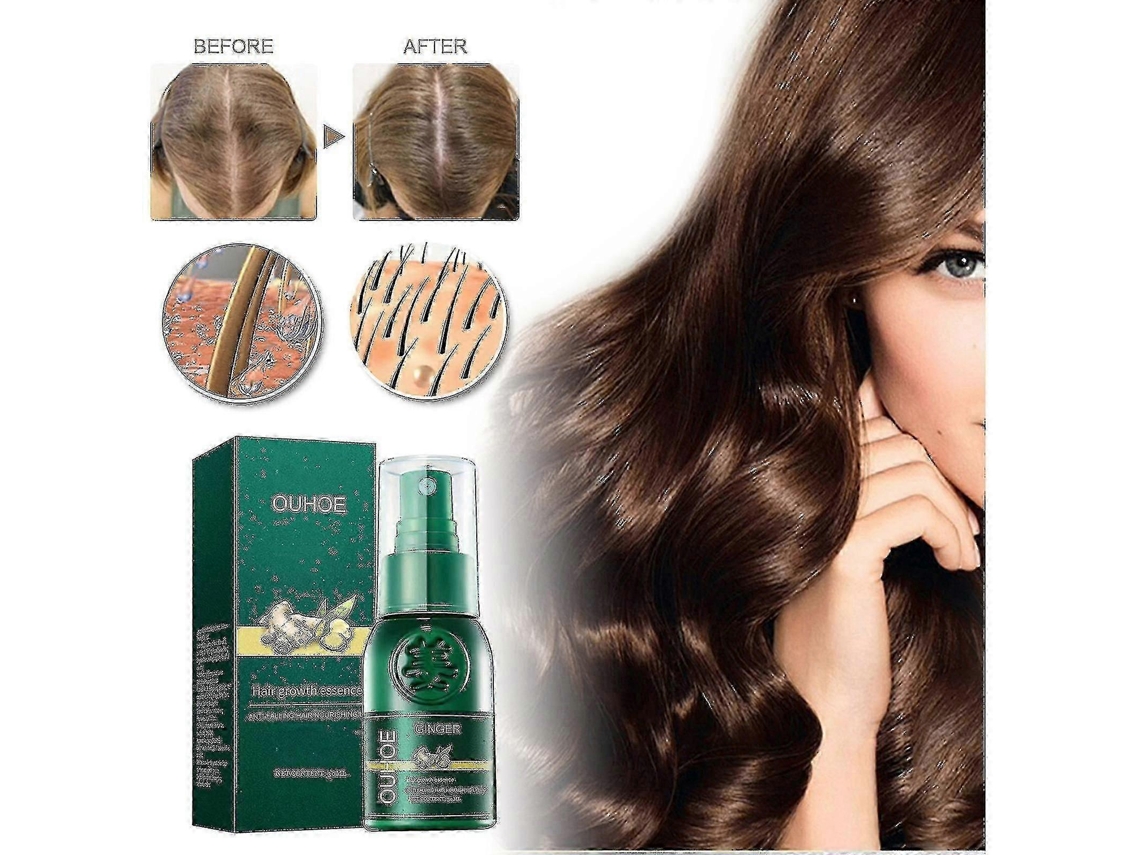 Ginger Hair Care Essential Oil Anti-loss Hair Growth Liquid Hair Grow