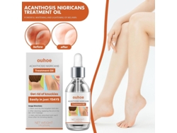 Kit de 2 Óleos de Tratamento para Acanthosis Nigricans 50ml