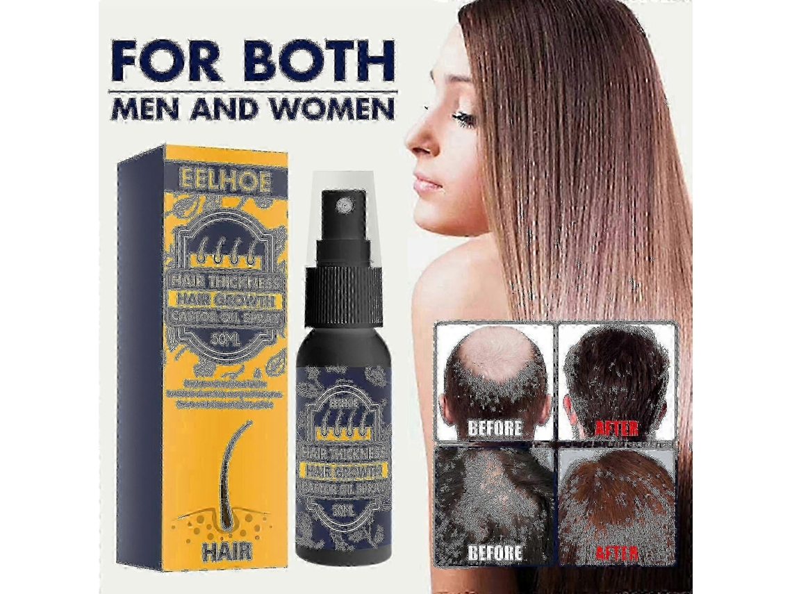 Castor Oil Hair Growth Spray -
