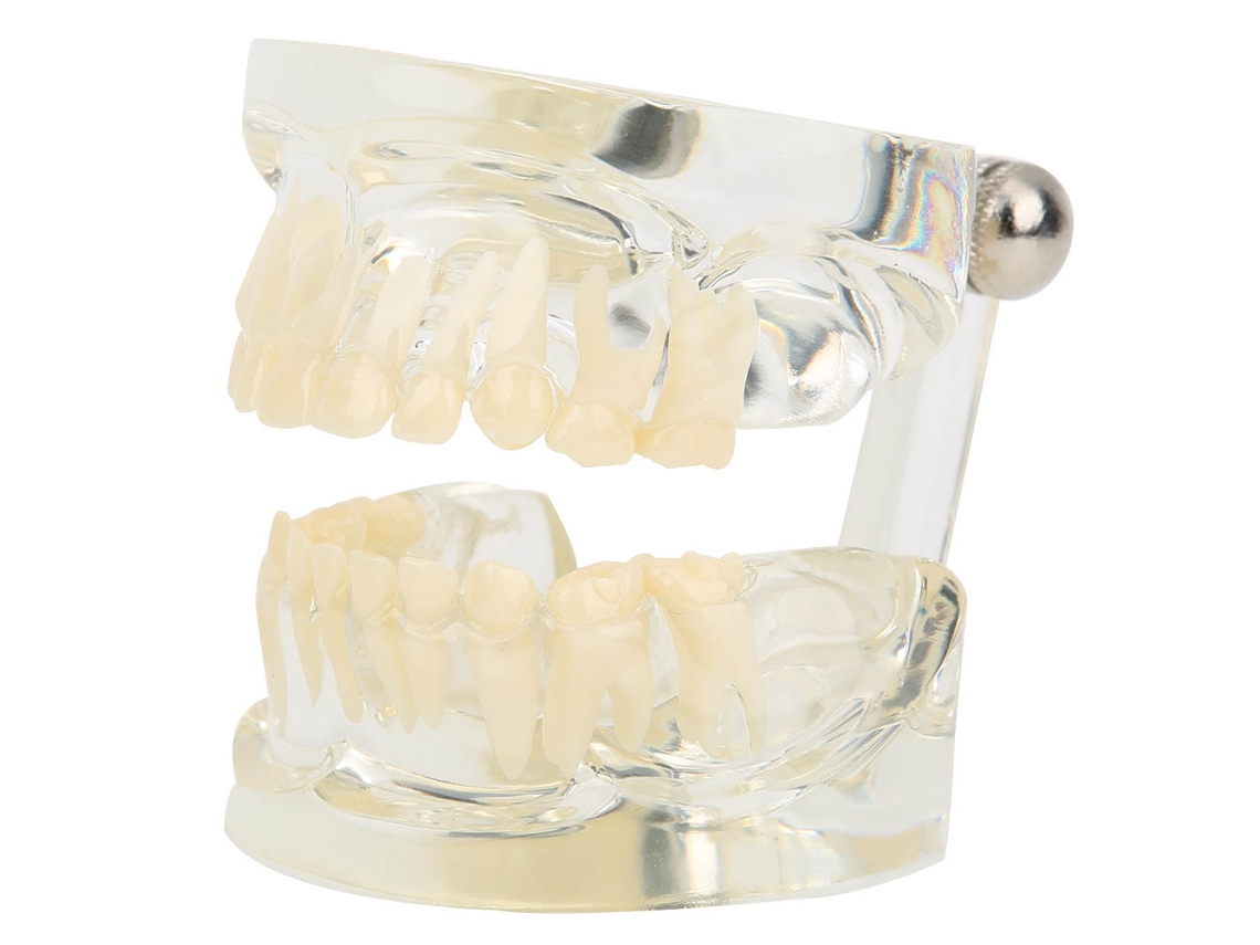 Modelo Transparente De Dientes De Leche Primarios Para La Enseñanza En Jardines De Infancia Y Hospitales.