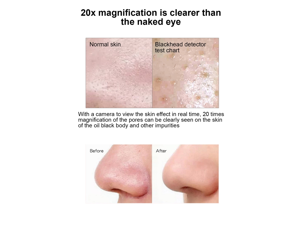 Extractor De Puntos Negros Con 4 Cabezas De Succión 6 Velocidades Limpiador Facial Profundo Herramienta De Belleza Para El Hogar