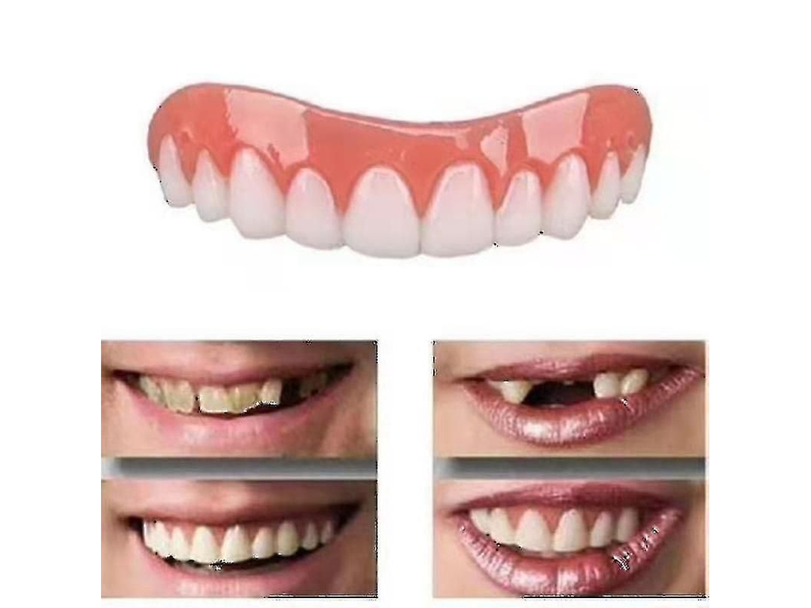 Dos Juegos De Prótesis Dentales Superiores E Inferiores, Naturales Y Cómodas, Protegen Los Dientes Y Devuelven Una Sonrisa Segura.