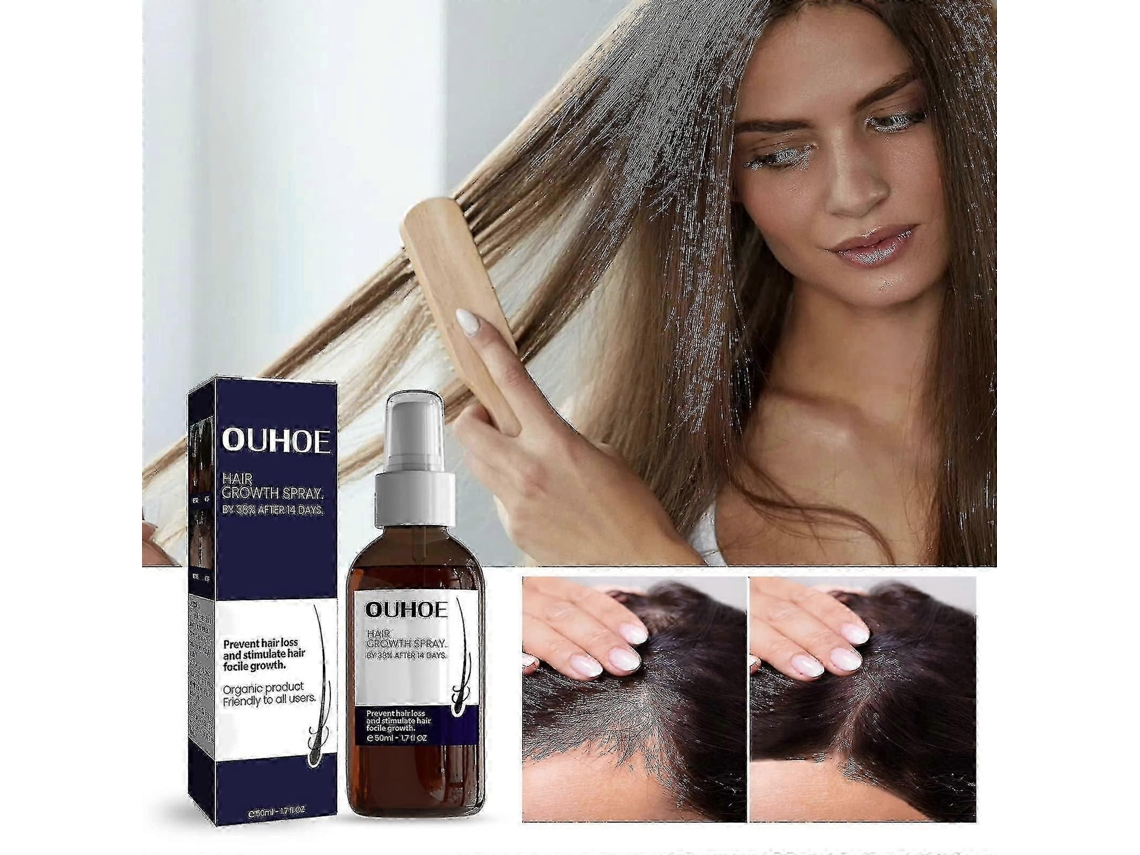 Ouhoe Super Hair Growth Formula Essence Spray, Ouhoe Super Hair Growth Formula Essence Spray, Makes Hair Thicker In 8 Week