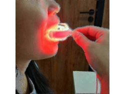 Nuevo modelo 2025: Tratamiento con luz LED roja para la cicatrización de heridas dentales y alivio de la gingivitis.