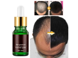 Aceite Para Crecimiento Capilar Natural Sin Efectos Secundarios Para Detener La Caída Y Regenerar Cabello Más Rápido