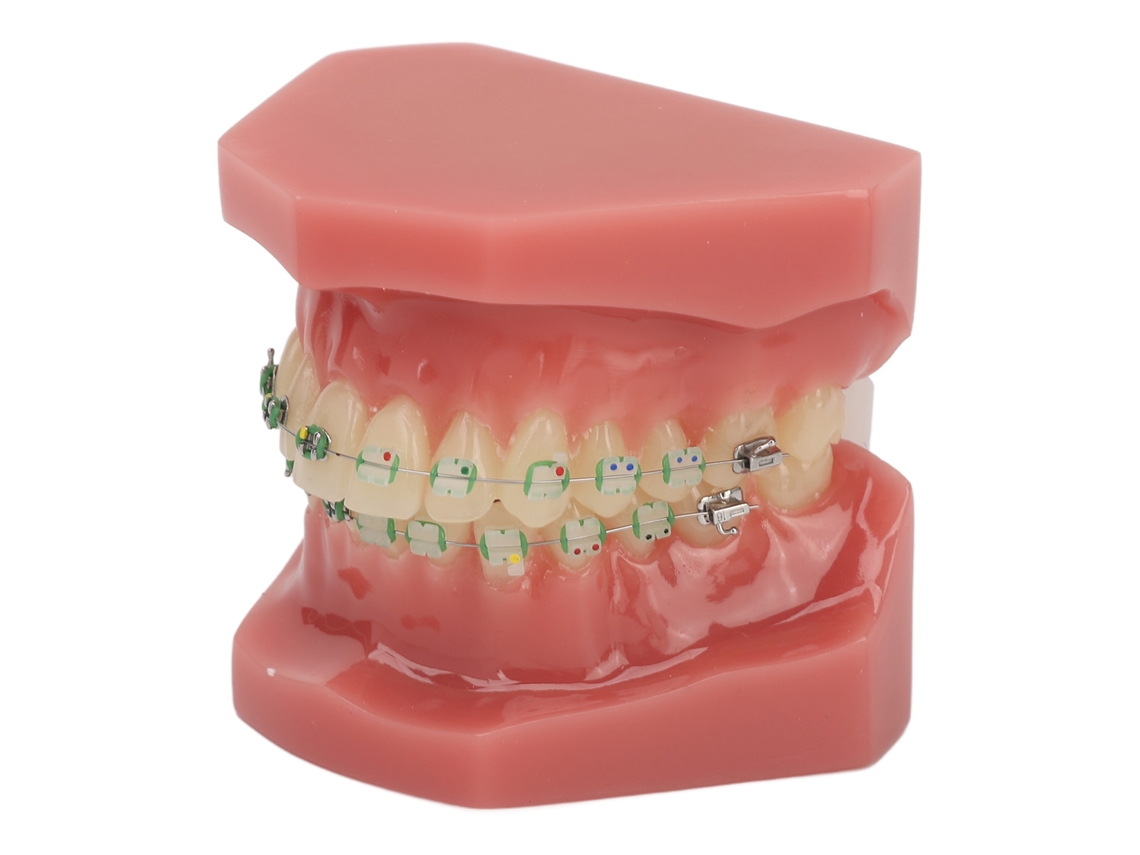 Modelo dental de ortodoncia con alambres y brackets metálicos para enseñanza y aprendizaje.