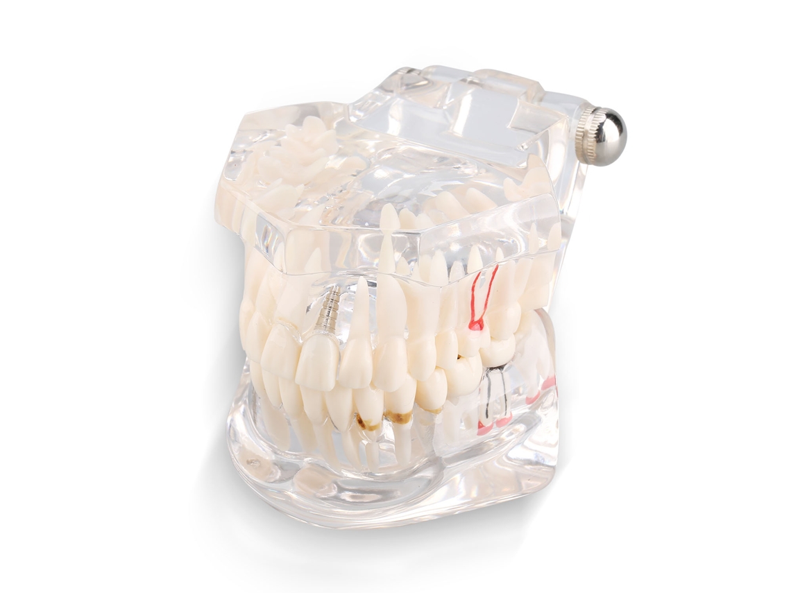 Modelo Dentes Ensino Odontológico Adulto Typodont Novo S/MARCA