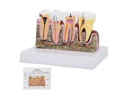 Modelo Anatómico Dental Removible Con Base Para Enseñanza Y Demostración.