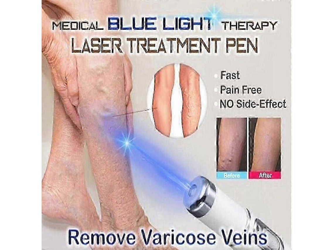 Lápiz de terapia de luz azul para eliminar venas varicosas, arrugas, acné y cicatrices - Dispositivo portátil para el cuidado de la piel