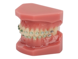 Modelo dental de ortodoncia con alambres y brackets metálicos para enseñanza y aprendizaje.