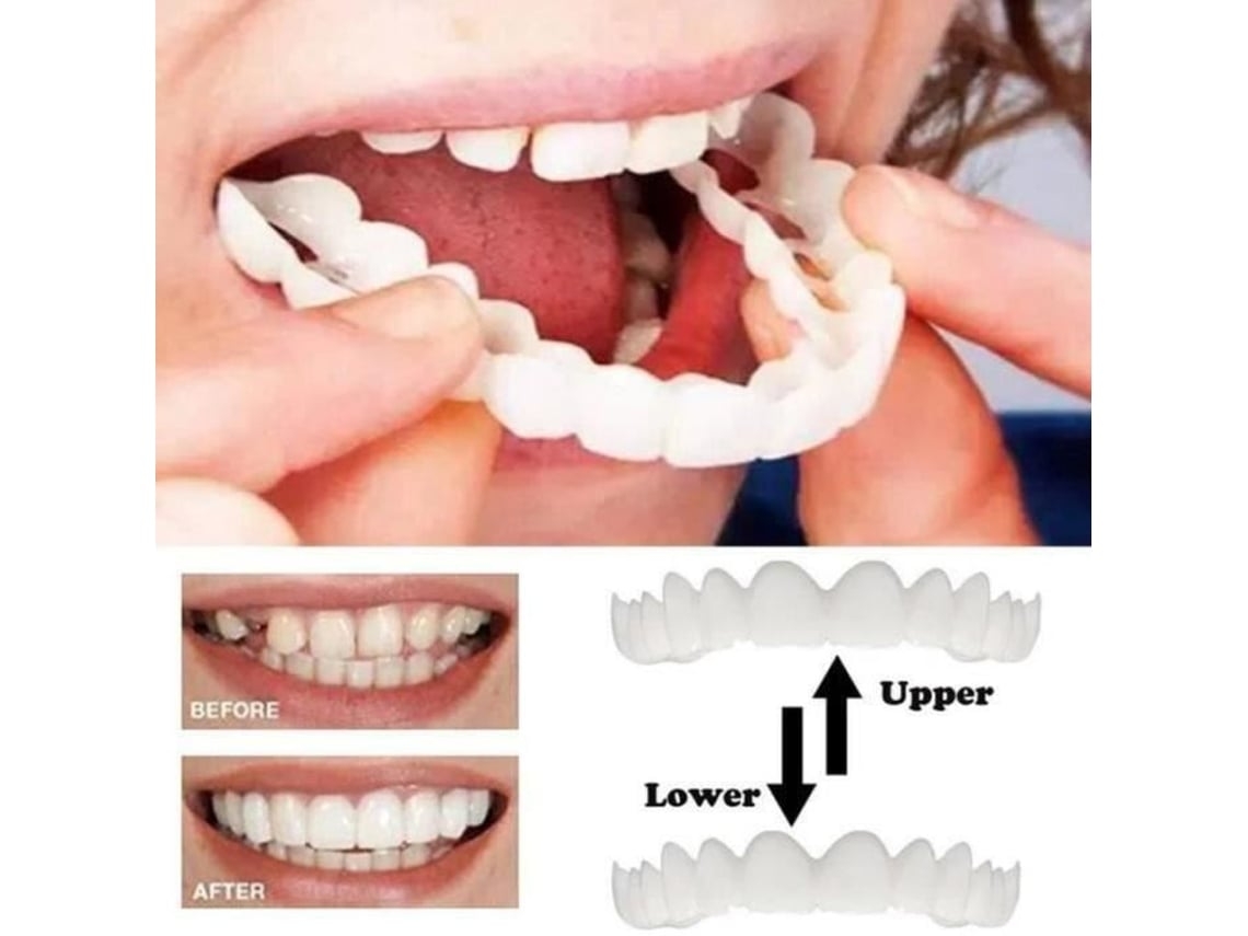 Un Par De Prótesis Dentales Superiores, Estéticamente Agradables, Cómodas, Juego Dentadura Flexible, Postiza. Resistente Al Agua
