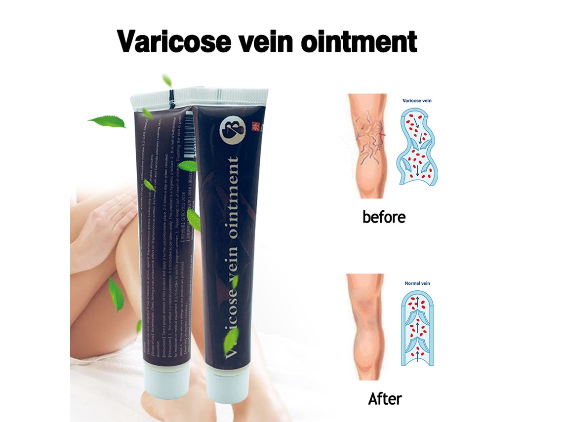 Crema Y Pomada Para Varices Y Cuidado De La Salud Vascular