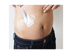Protector Transparente Para Heridas Impermeable Desechable Barrera De Humedad 50 Piezas Paquete