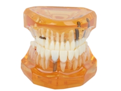 Modelo De Dientes Desmontable Naranja Para Enseñanza Y Estudio Dental